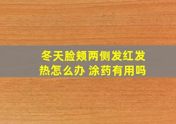 冬天脸颊两侧发红发热怎么办 涂药有用吗